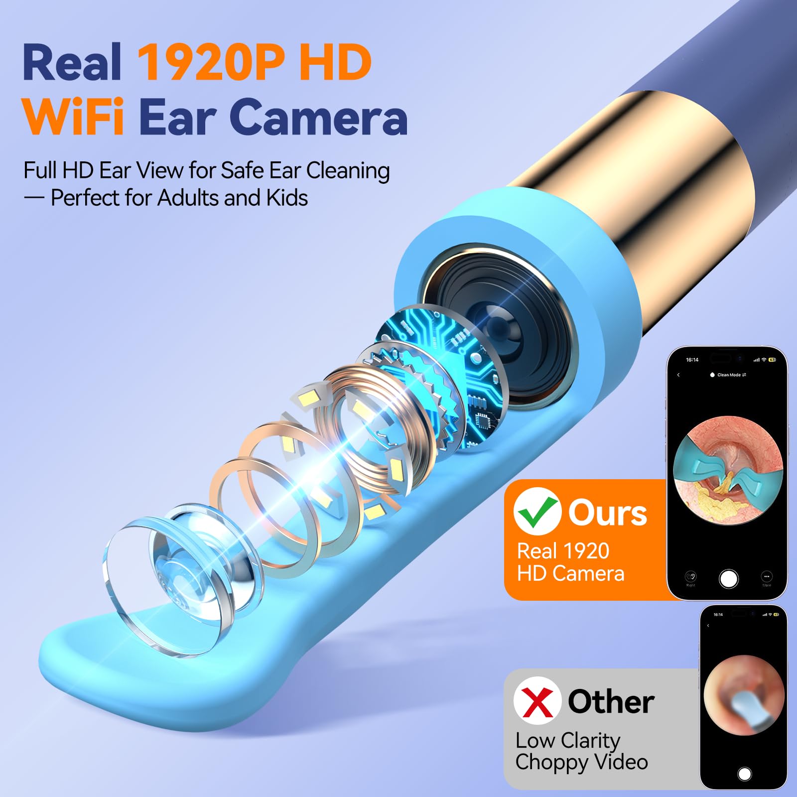 Otoscope Oreille HD WiFi 1920p avec Caméra Flexible Grand Angle 360° Lumière pour Examens ORL Adultes Enfants