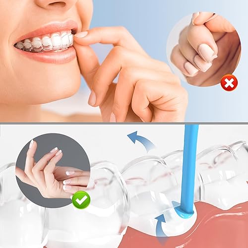 Miniatura 5 de Herramienta de extracción de alineadores, 5 herramientas de extracción de llaves invisibles, herramienta de extracción de retenedores, adecuada para