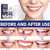 Tooth Filling Repair Kit,Missing Tooth Replacement,Temporary Tooth Replacement Restores Natural Dental Health,Ensures A Firm Bite,Can Be Used at Any Time,Easy to use