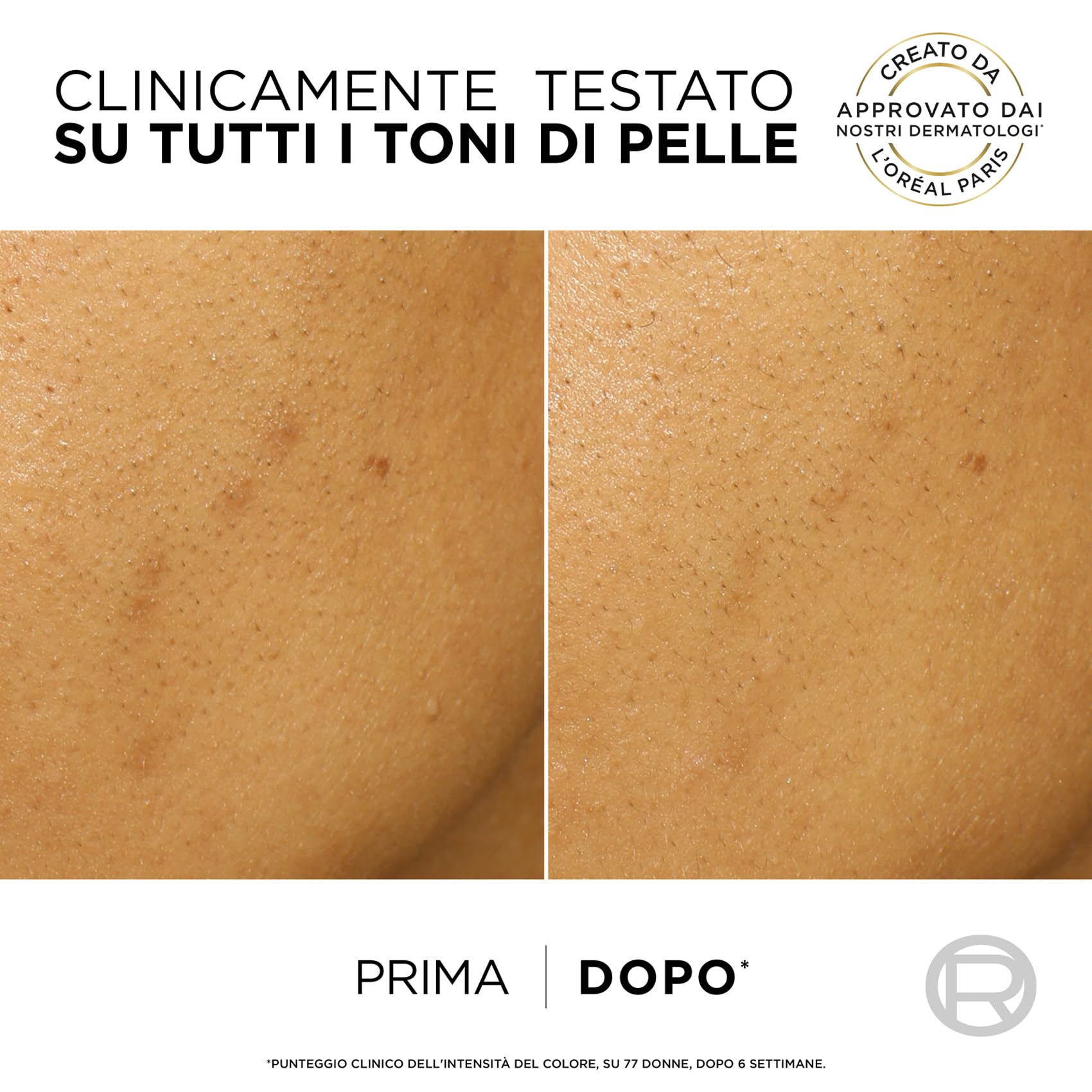 L’Oréal Paris Peeling Esfoliante, Per Tutti i Tipi di Pelle, Incarnato Levigato e Uniforme, Con Niacinamine e 25% AHA + BHA + PHA, Bright Reveal, 25 ml