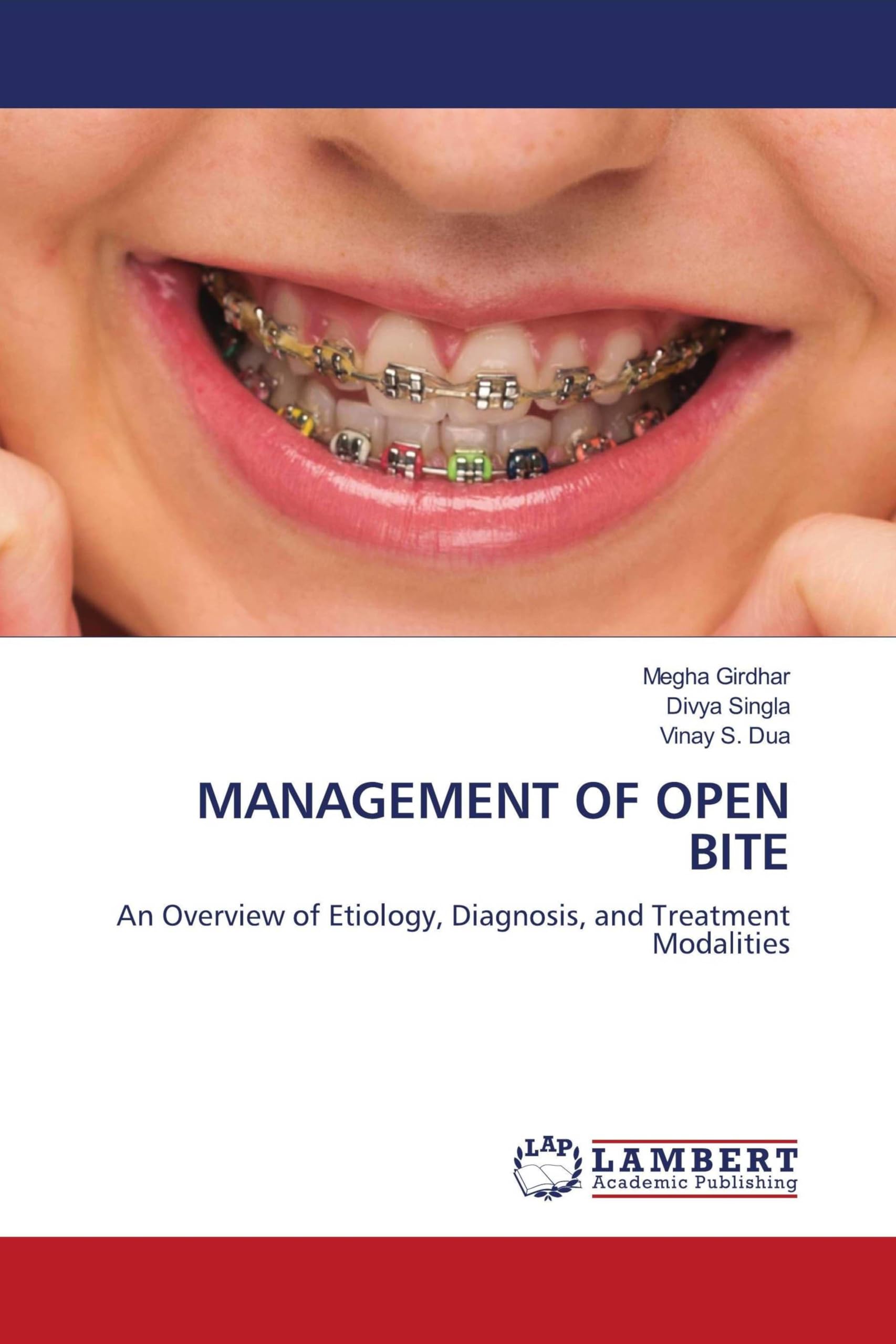 Management of Open Bite: An Overview of Etiology, Diagnosis, and Treatment Modalities