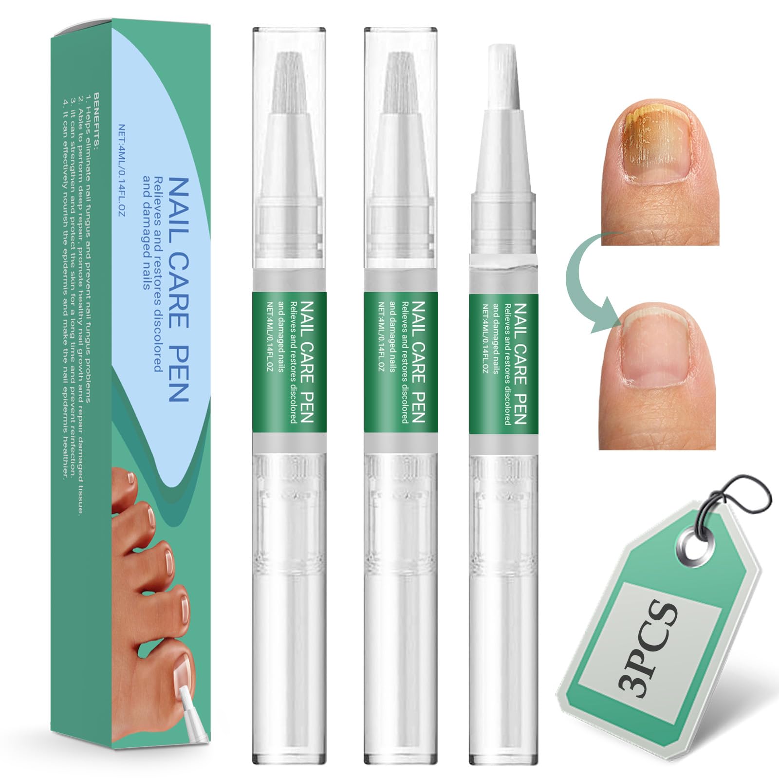 3 Pieces Nail Care Pen,Nail Repairers Solution,Toenail Care,Toe Care and Pedicure, transparent, 3 count (Pack of 1)