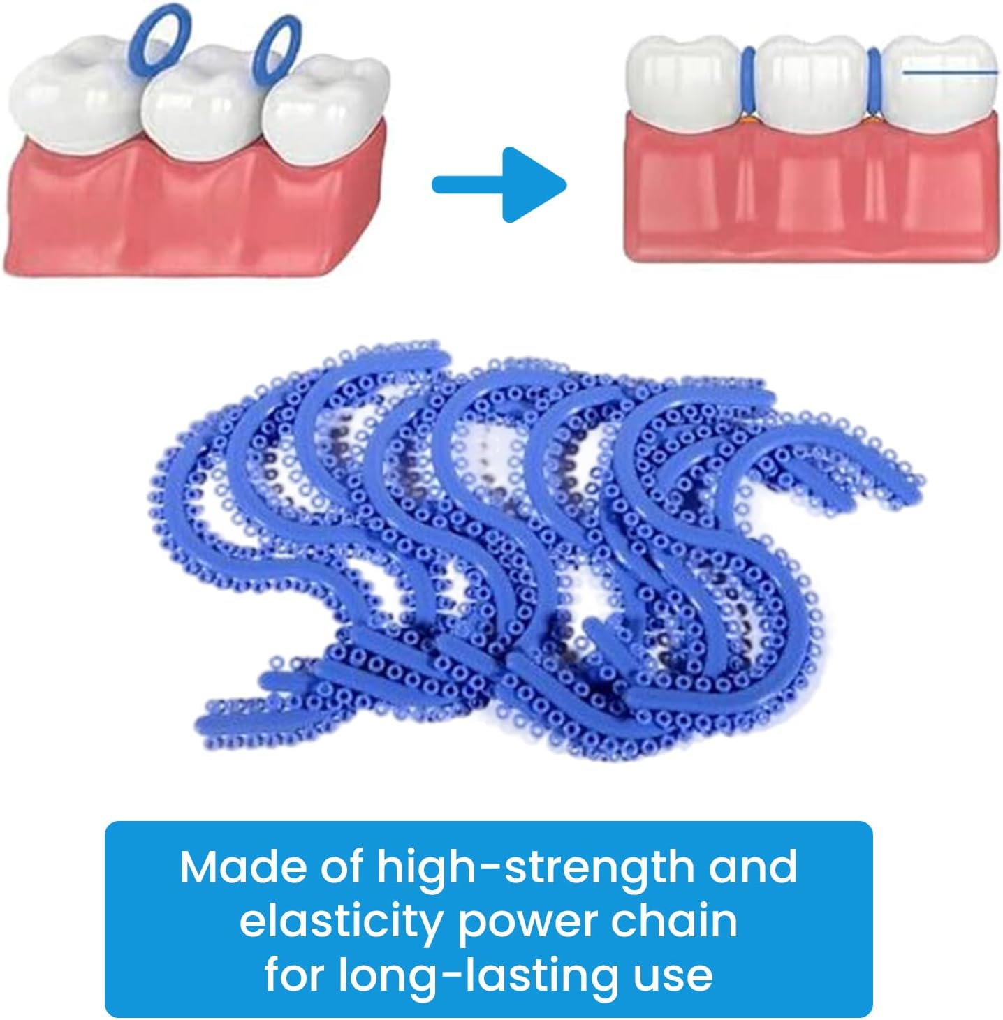 700 Pieces Orthodontic Braces Separator Elastic Ligature Ties, Dental O Ring Rubber Bands for Teeth, Latex Free Orthodontic Supplies