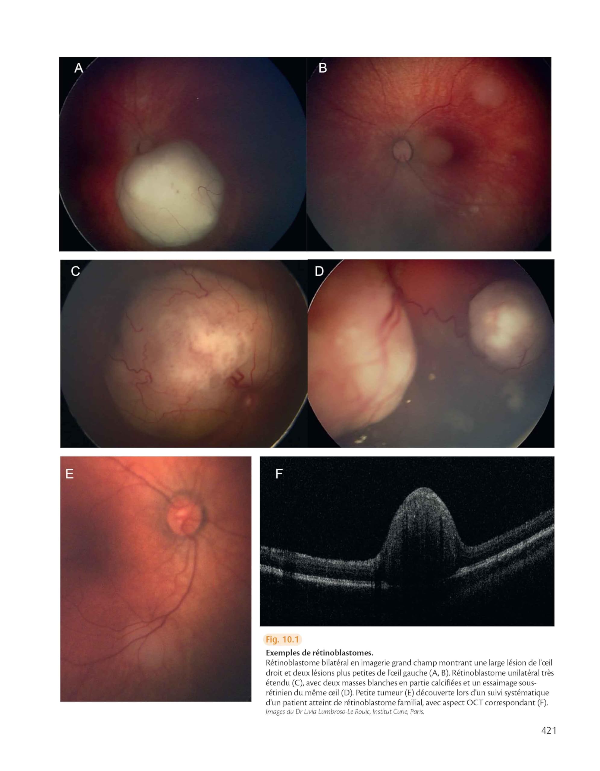 Rétine : atlas des maladies du fond d'oeil