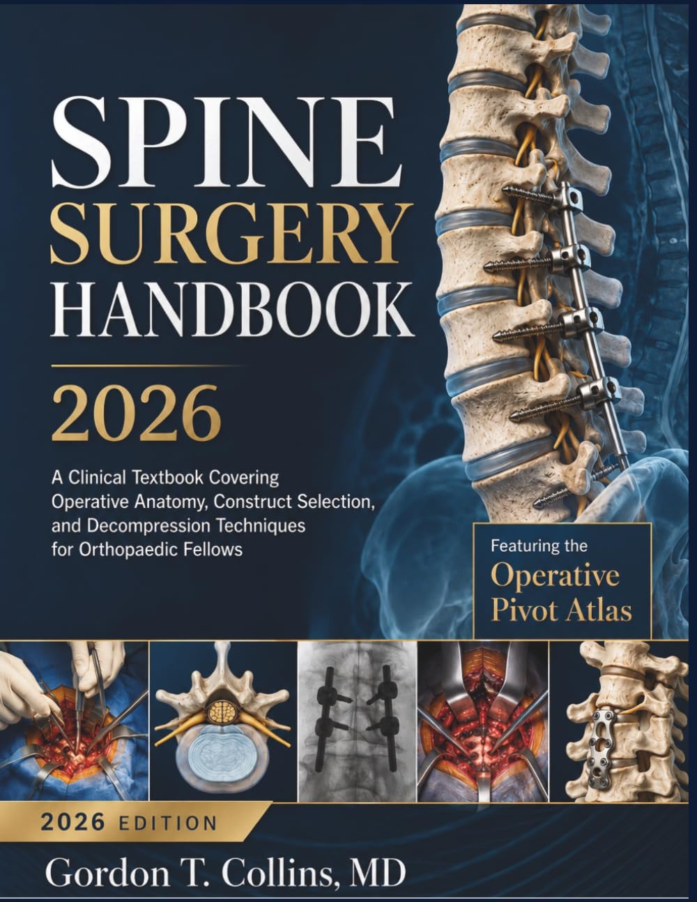 Spine Surgery Handbook 2026: A Clinical Textbook Covering Operative Anatomy, Construct Selection, and Decompression Techniques for Orthopaedic Fellows