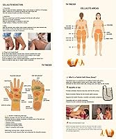 Vista 7 de Herramienta de masaje de fascia, herramientas de masaje de punto de activación, anti blaster, herramienta de masajeador de celulitis, que alcanza