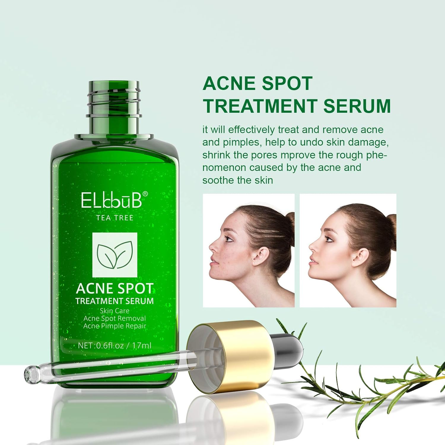 Acne Treatments Serum,Acne Spot Treatment Tea Tree Clear Skin Serum for
