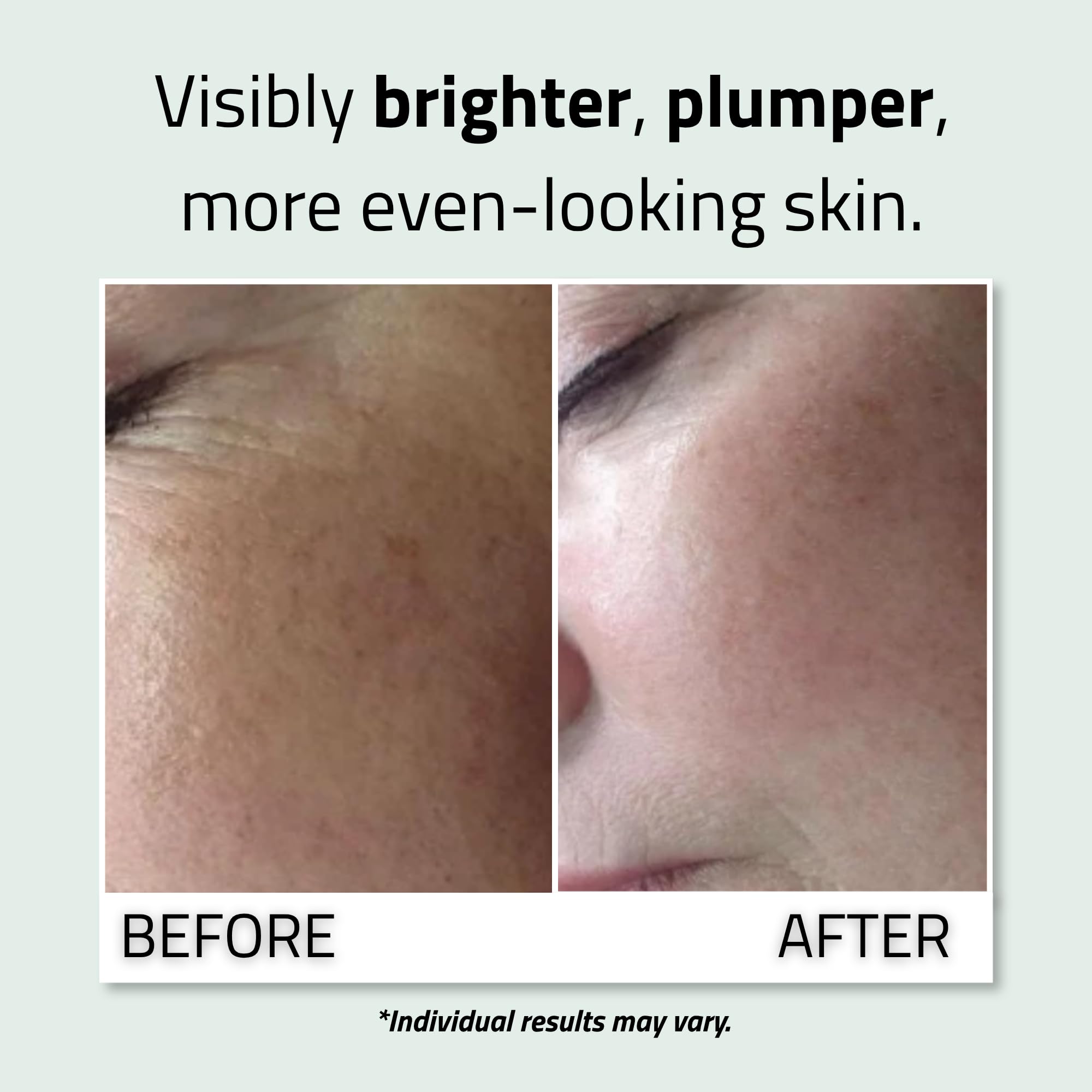 YEOUTH Hyaluronic Acid Facial Skincare