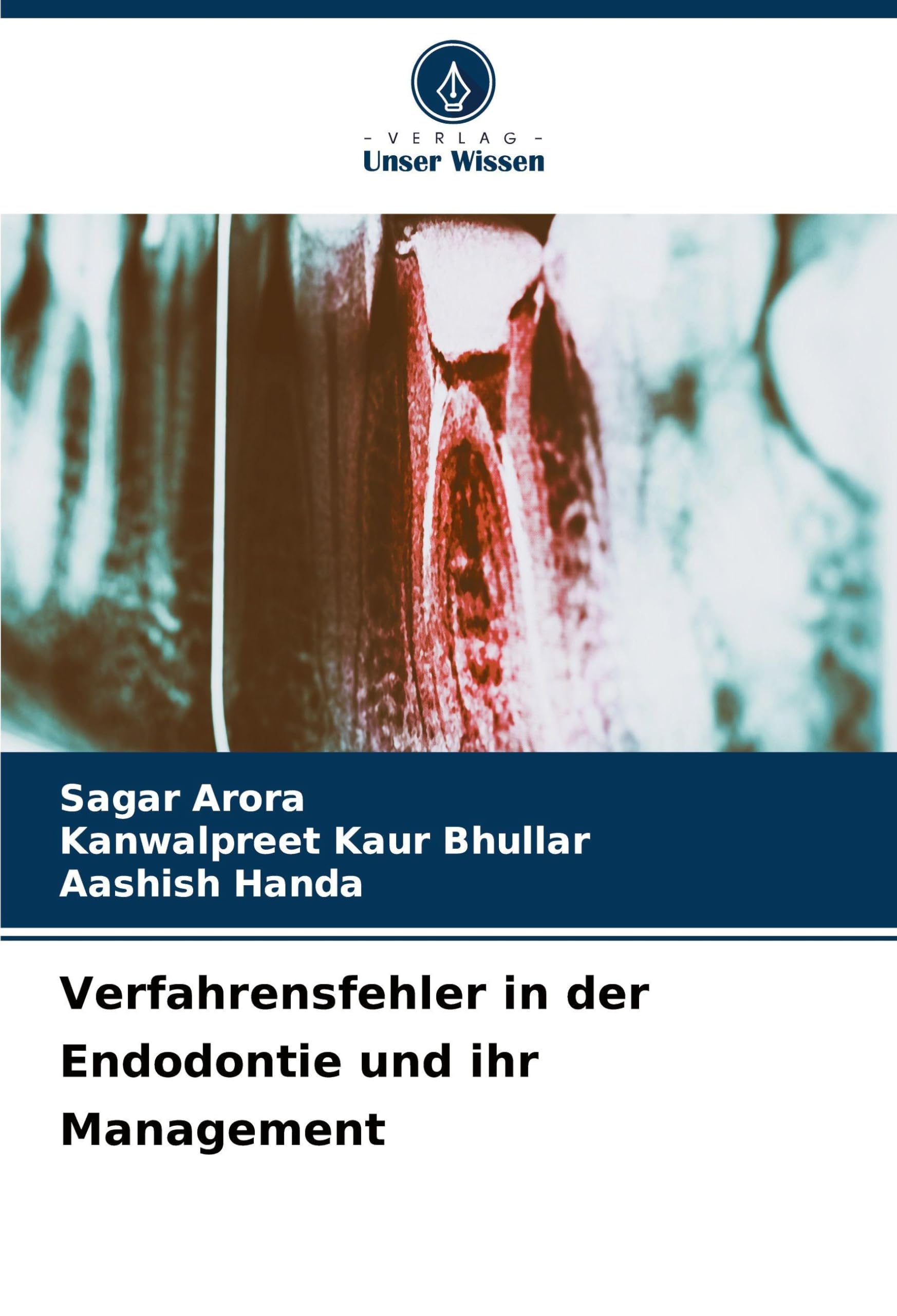 Verfahrensfehler in der Endodontie und ihr Management