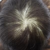 Vista 6 de Tupé para hombre, pieza de cabello humano real, sistema de reemplazo para hombres, piel ultrafina, tupé, línea capilar natural, tupé para hombre, 3#