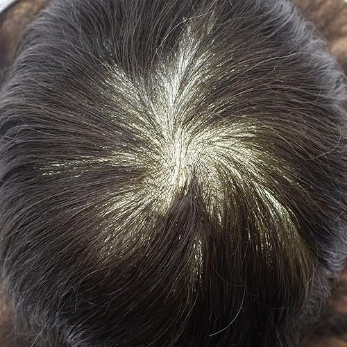 Miniatura 6 de Pieza de pelo para hombre, tupé de cabello humano real para hombres, piezas de cabello, sistema de reemplazo para hombres, piel ultrafina, 0.002 in,