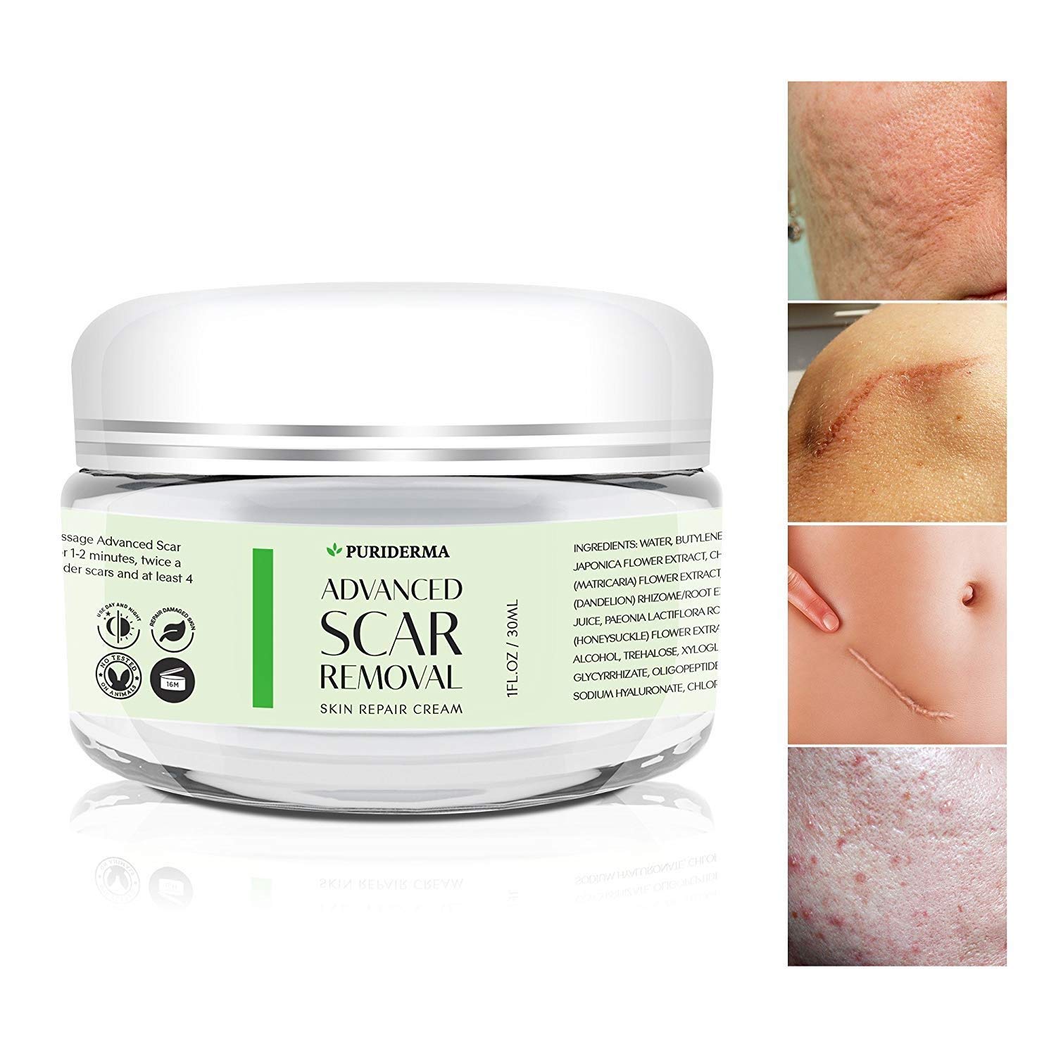 Puriderma Scar Removal Cream - Advanced Treatment for Face & Body, Old & New Scars from Cuts, Stretch Marks, C-Sections & Surgeries - With Natural Herbal Extracts Formula