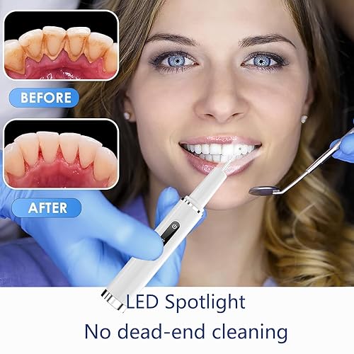 Miniatura 5 de Removedor de placa profesional para dientes, herramienta limpiadora de dientes con tecnología de sensor inteligente y segura, 4 cabezales