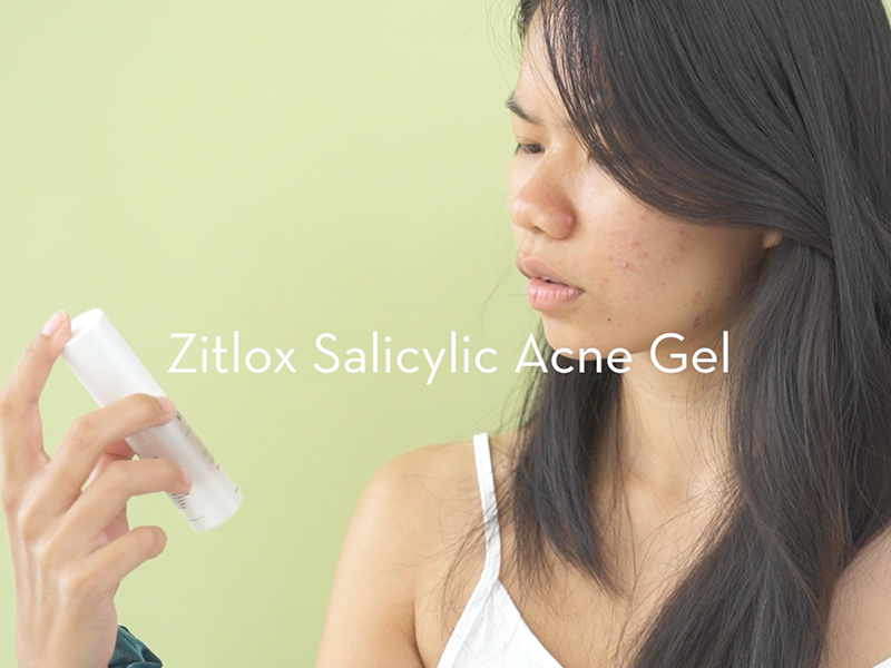 Sonage Zitlox Salicylic Acne Gel: Spot Treatment with Tea Tree Oil | Clears Acne Blemishes | Benzoyl Peroxide Alternative