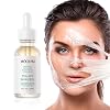 TCA Peel TCA Chemical Peel 40 Percent, Peeling Serum with Malic Acid and Citric Acid, Peeling Solution Face Exfoliator Exfoliate for Face, Facial Exfoliant for Dark Skin, Dark Spots, Acne, Blemish- 30ml