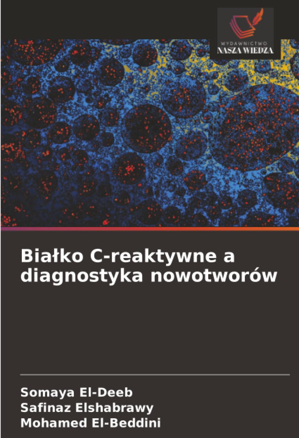 Bia¿ko C-reaktywne a diagnostyka nowotworów