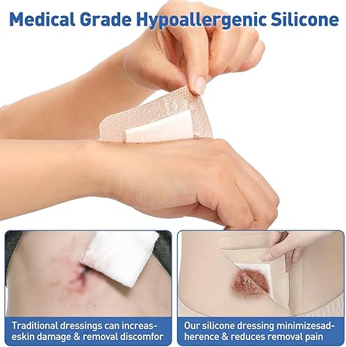 Miniatura 10 de AZEN Paquete de 12 rollos de gasa, 4 pulgadas x 4.1 yardas, suministros médicos de primera calidad y suministros de primeros auxilios, vendaje para