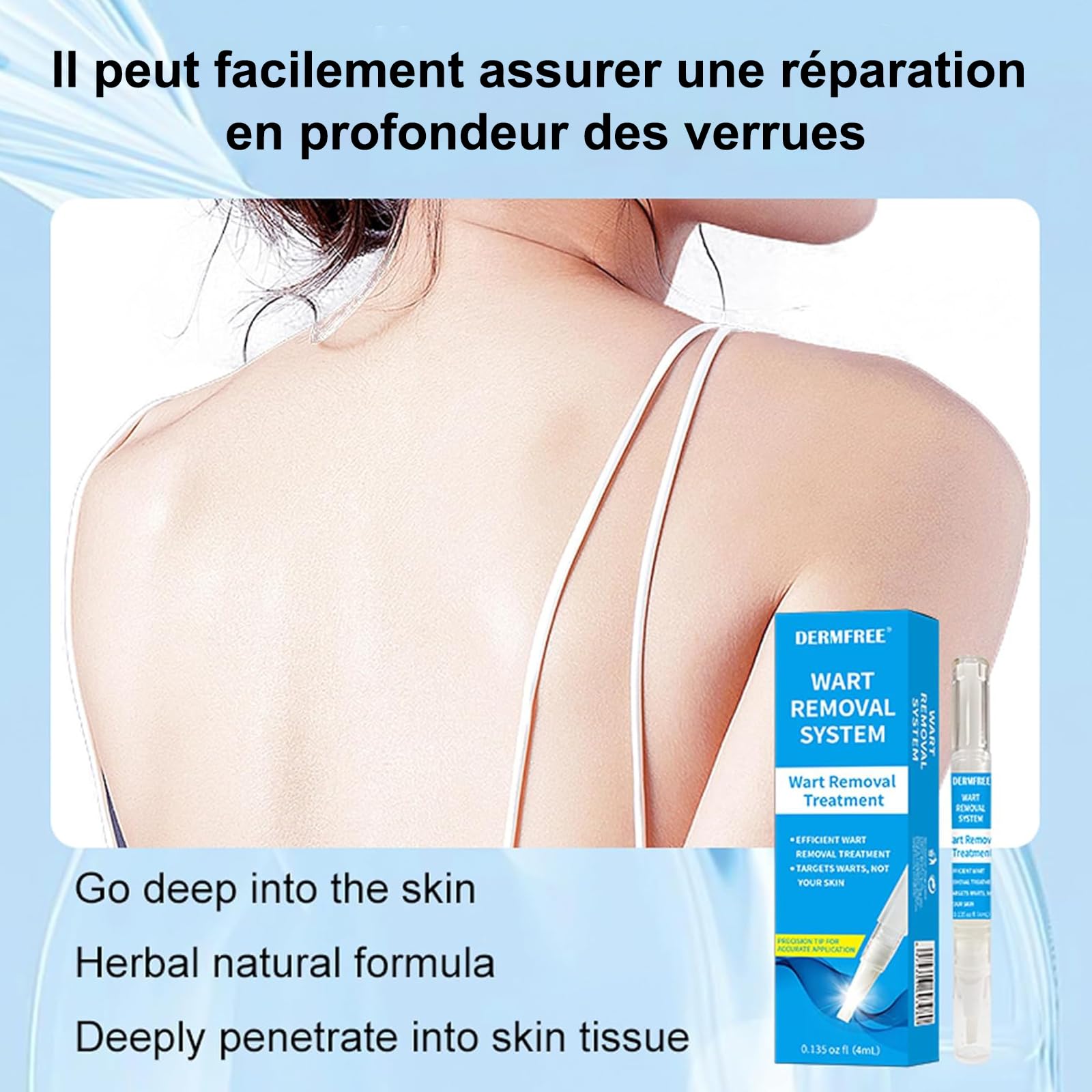 Crème D'élimination des Verrue Plantaire, Stylo anti-verrues 4ML