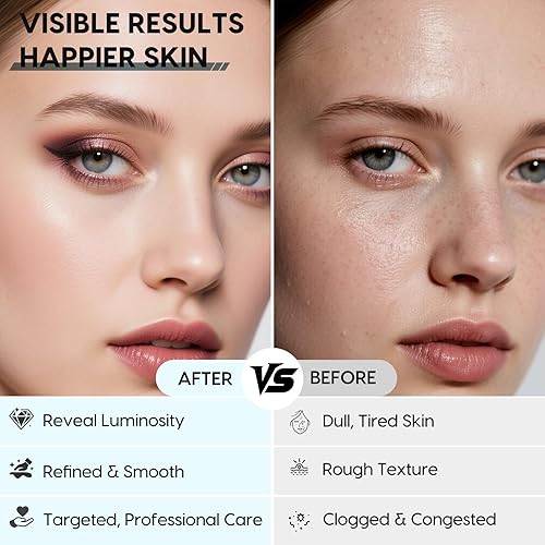 Miniatura 5 de Cepillo de limpieza facial de silicona  2 unidades de exfoliante de doble extremo para limpieza profunda de poros, eliminación de puntos negros y