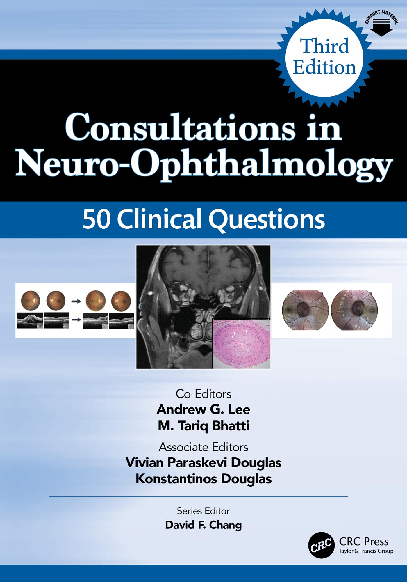 Consultations in Neuro-Ophthalmology: 50 Clinical Questions (Curbside Consultation in Ophthalmology) (English Edition)