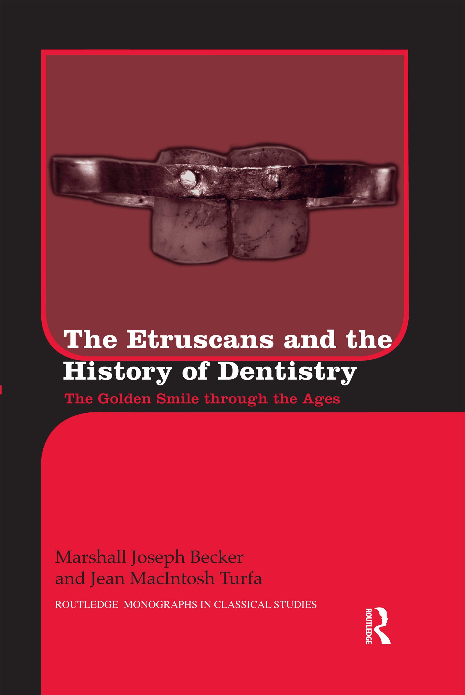 The Etruscans and the History of Dentistry (Routledge Monographs in Classical Studies)
