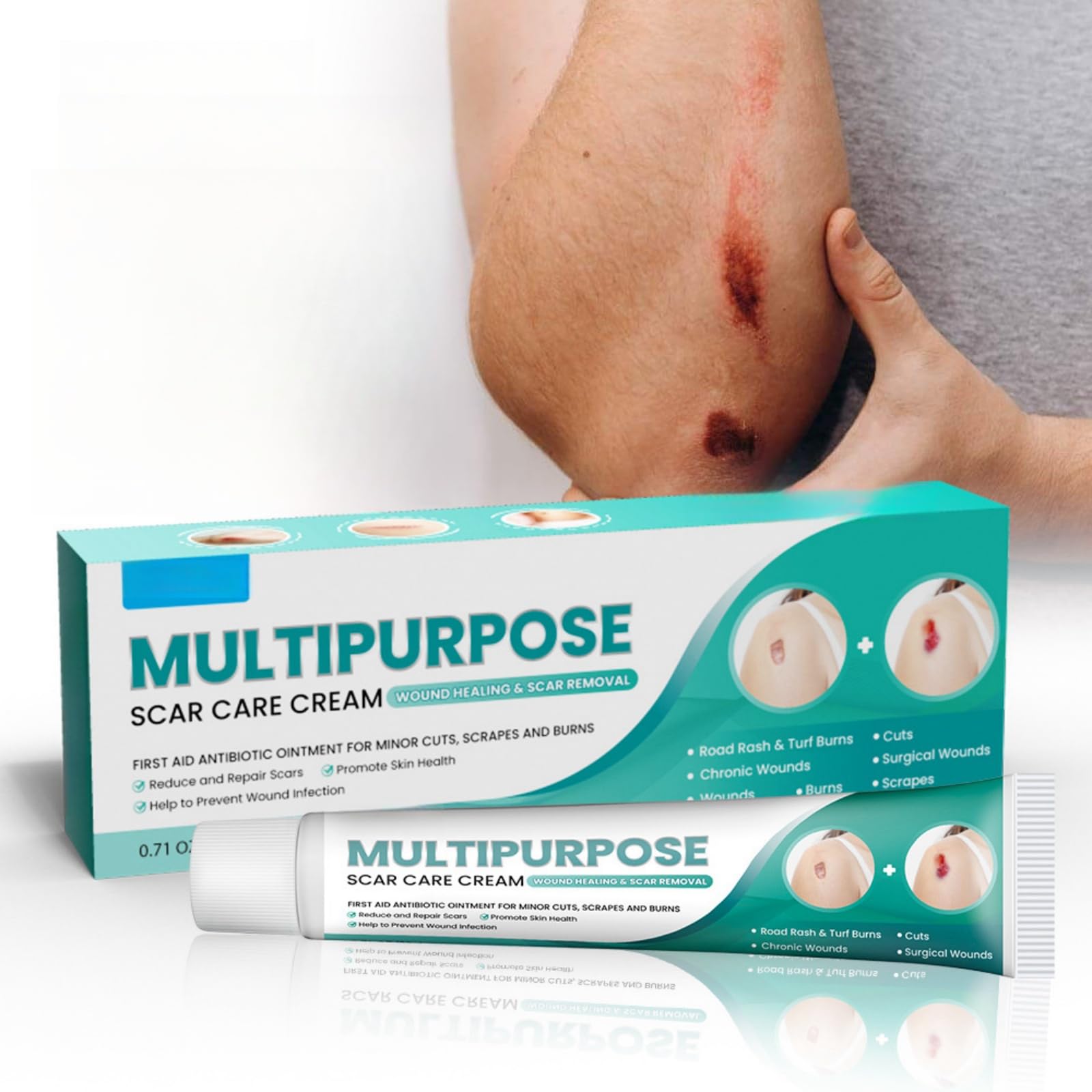 NOVOLAN Multipurpose Scar Care Cream 20g, Gentle Scar Treatment for Fading Pregnancy Marks, Burns, Smoothens Skin, Hydrating Formula for Skin Restoration, Effective Acne Scar & Dark Spot Repair