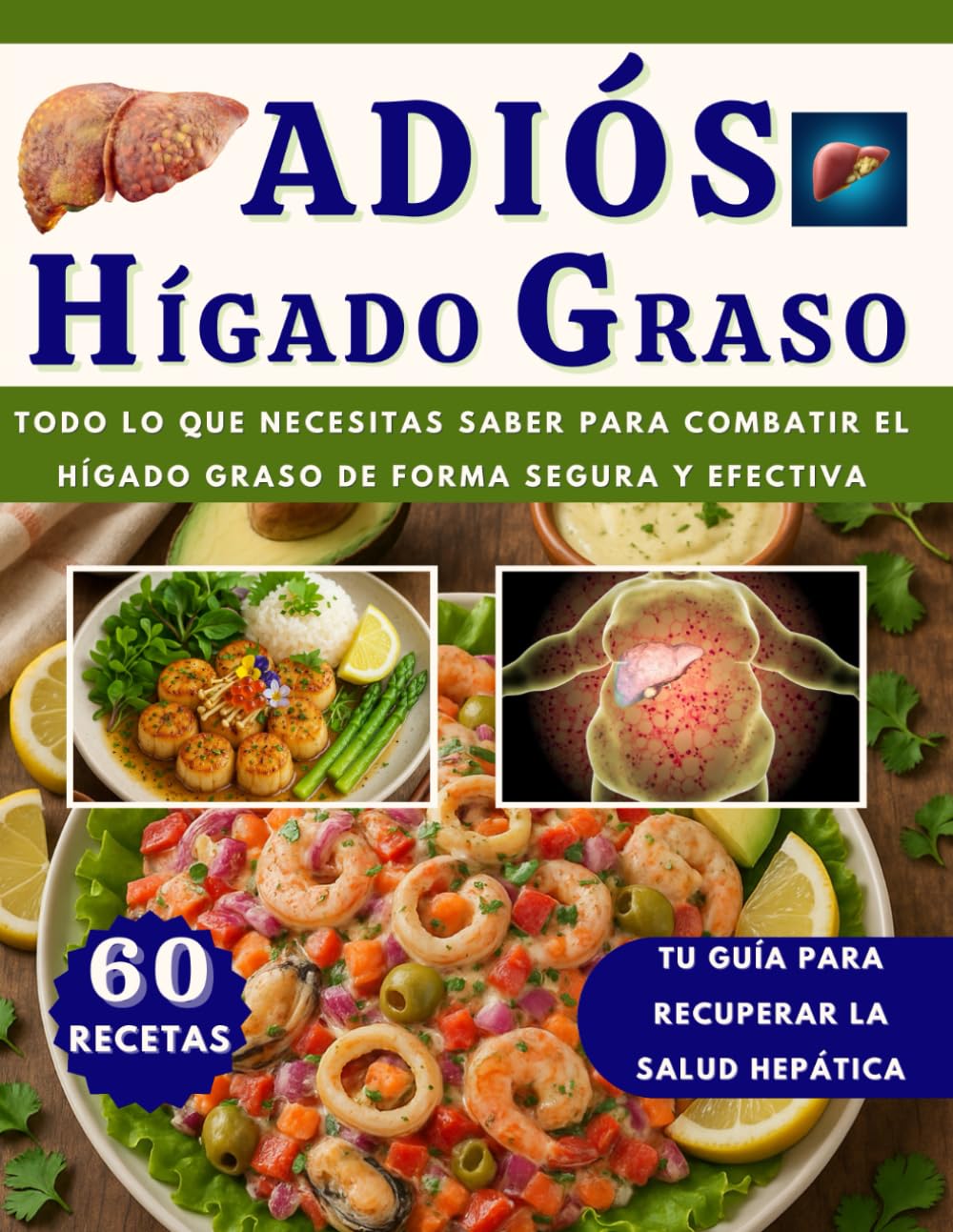 ADIÓS HÍGADO GRASO: Todo lo que Necesitas Saber para Combatir el HÍGADO GRASO de Forma Segura y Efectiva (INCLUYE 60 RECETAS CON IMÁGENES)