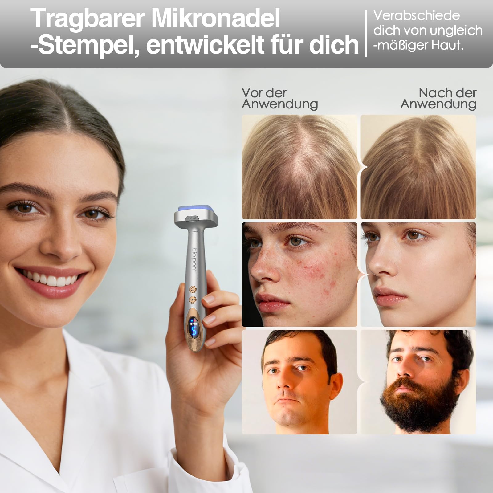 bio 6 Derma Stamp Elektrisch Upgrade 2026 | 4-in-1 Dermastamp Microneedling für Gesicht & Kopfhaut, 140 Pins, Rot & Blau LED Lichtpflege, sanfte Massage | inkl. 2 Aufsätze: 0,5 mm(Graugold)