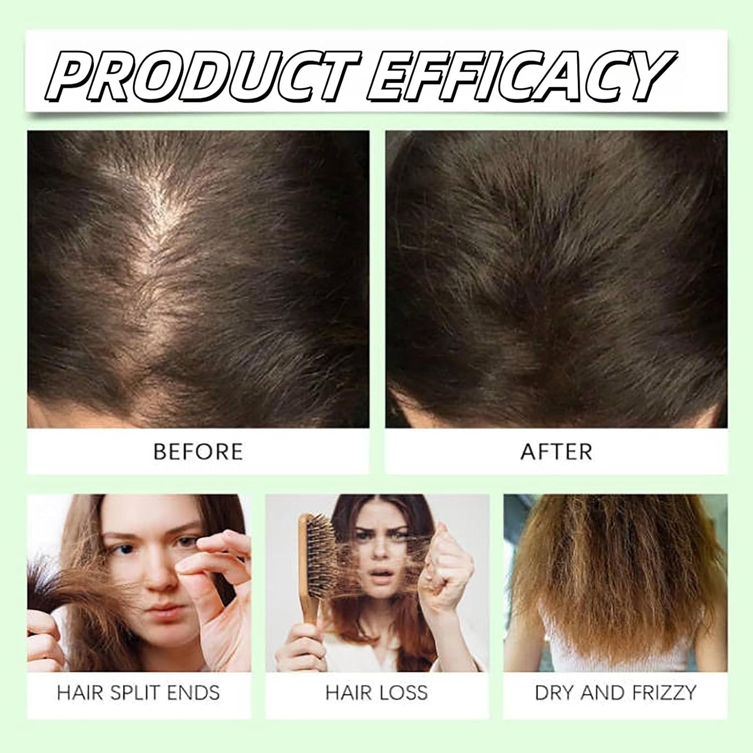 Remimpi Anti-Hair Fall Hair Loss Shampoo,Anti-Hair Fall Promote Hair Growth for Women & Men Hair Loss,Enriched with Multiple Botanical Extracts, Suitable for All Hair Types,10.58 FL OZ (300ml) - Image 6