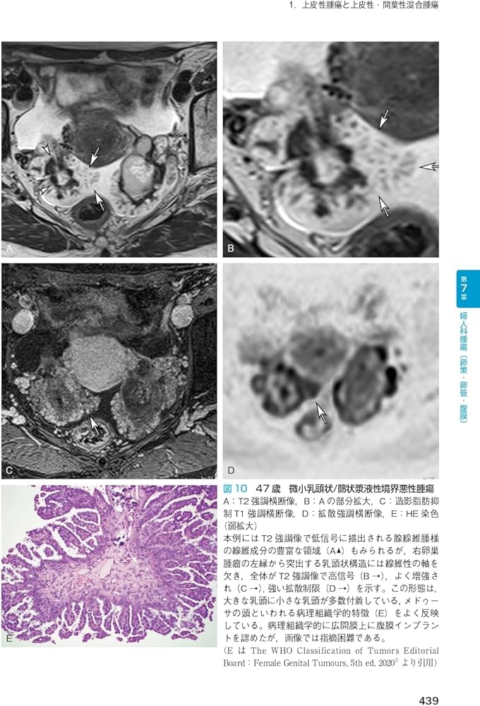 産婦人科の画像診断 第2版 産婦人科の画像診断 第2版 | 田中 優美子 |本 | 通販 | Amazon
