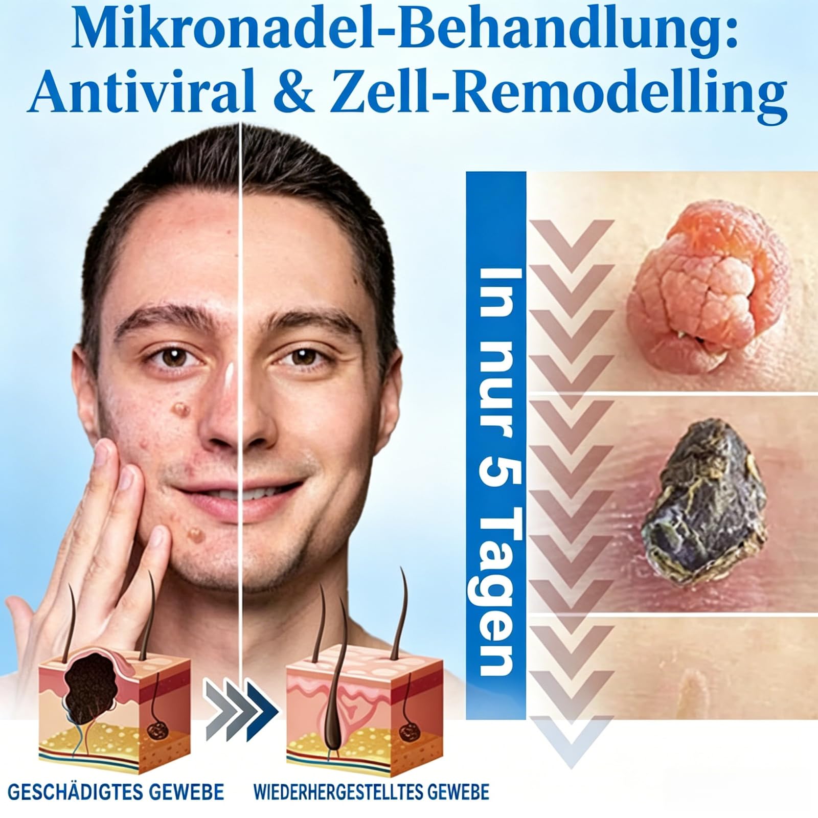 Celsiora 2 en 1 parche hidrocoloide con microagujas e hidrocoloides, 2026 nuevo parche hidrocoloide para cara y cuerpo, cuida la piel, adecuado para todo tipo de piel (4 cajas)