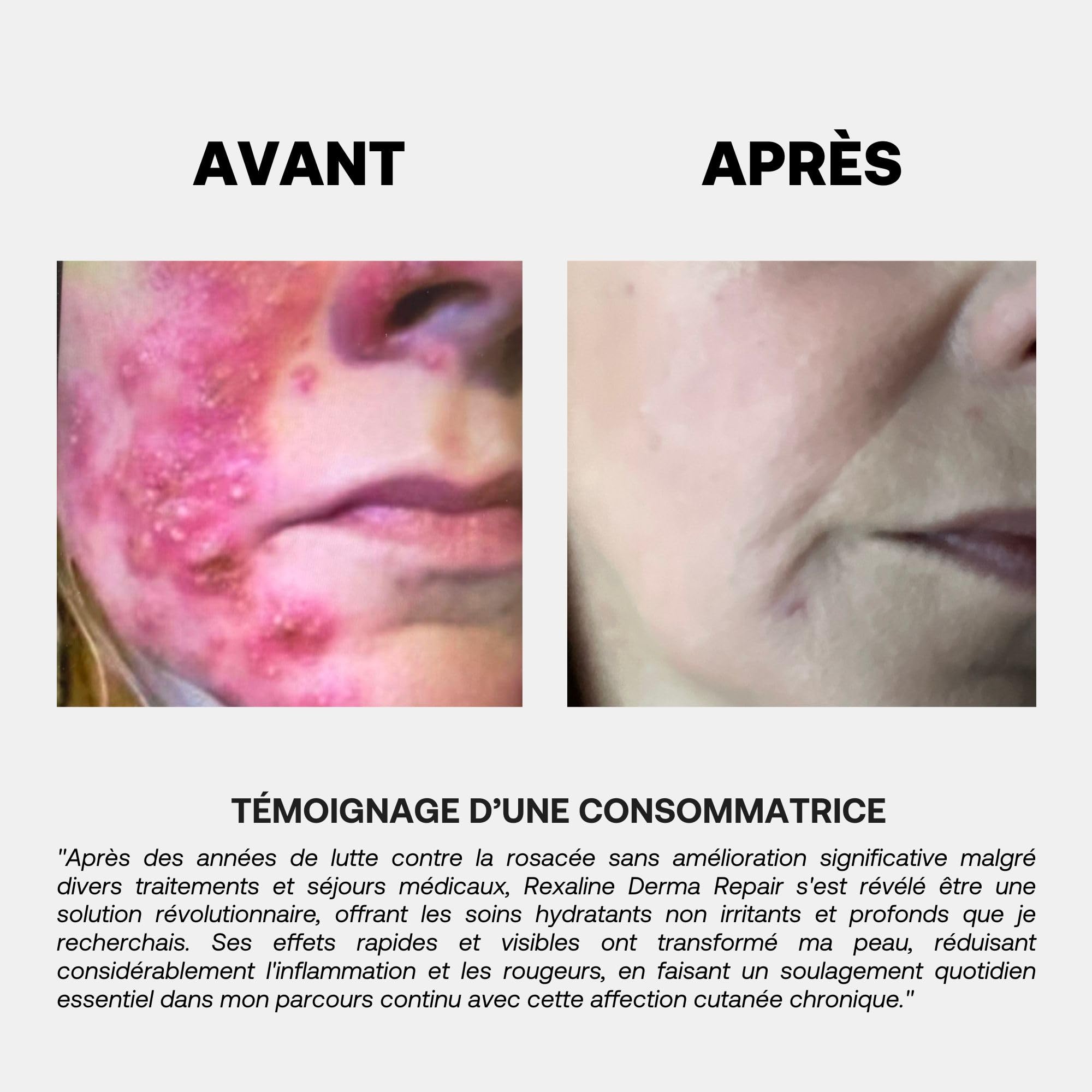 Rexaline Derma Repair Crème – Soin Réparateur Peaux Sensibles, Sèches ou Irritées – Hydratation Profonde & Apaisement – Acide Hyaluronique RX2 – Sans Silicone – 50ml