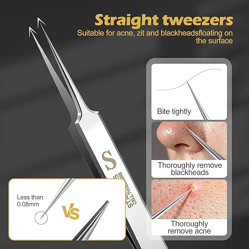 Miniatura 2 de WSYUB Pinzas profesionales para puntos negros, herramientas para quitar puntos negros,Kit de depilación encarnada