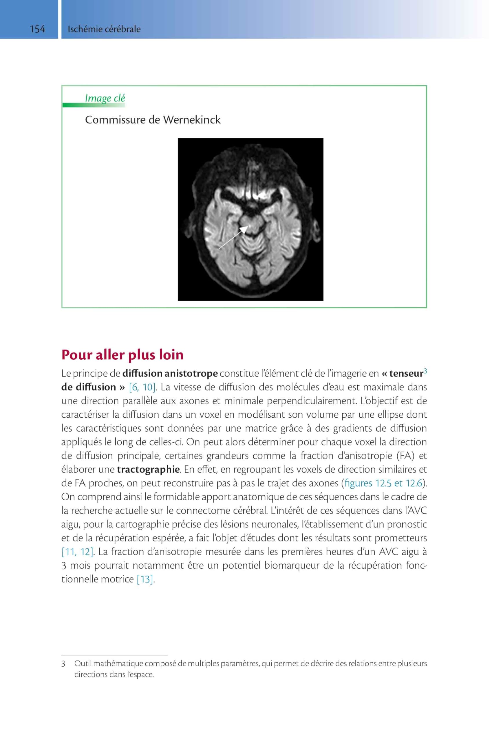 Imagerie de l'accident vasculaire cérébral ischémique aigu: Méthode d'auto-apprentissage