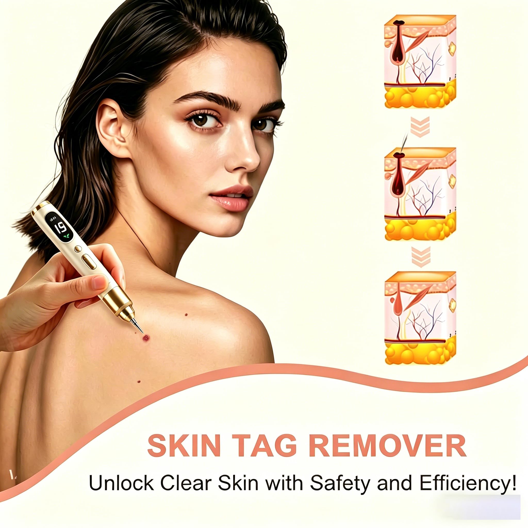 Dissolvant Traitement Verrues Plasma, Électrique Removal Pen avec 19 Niveaux Réglables et Spot LED pour Taches de Rousseur Taches Foncées Tatouages Verrues