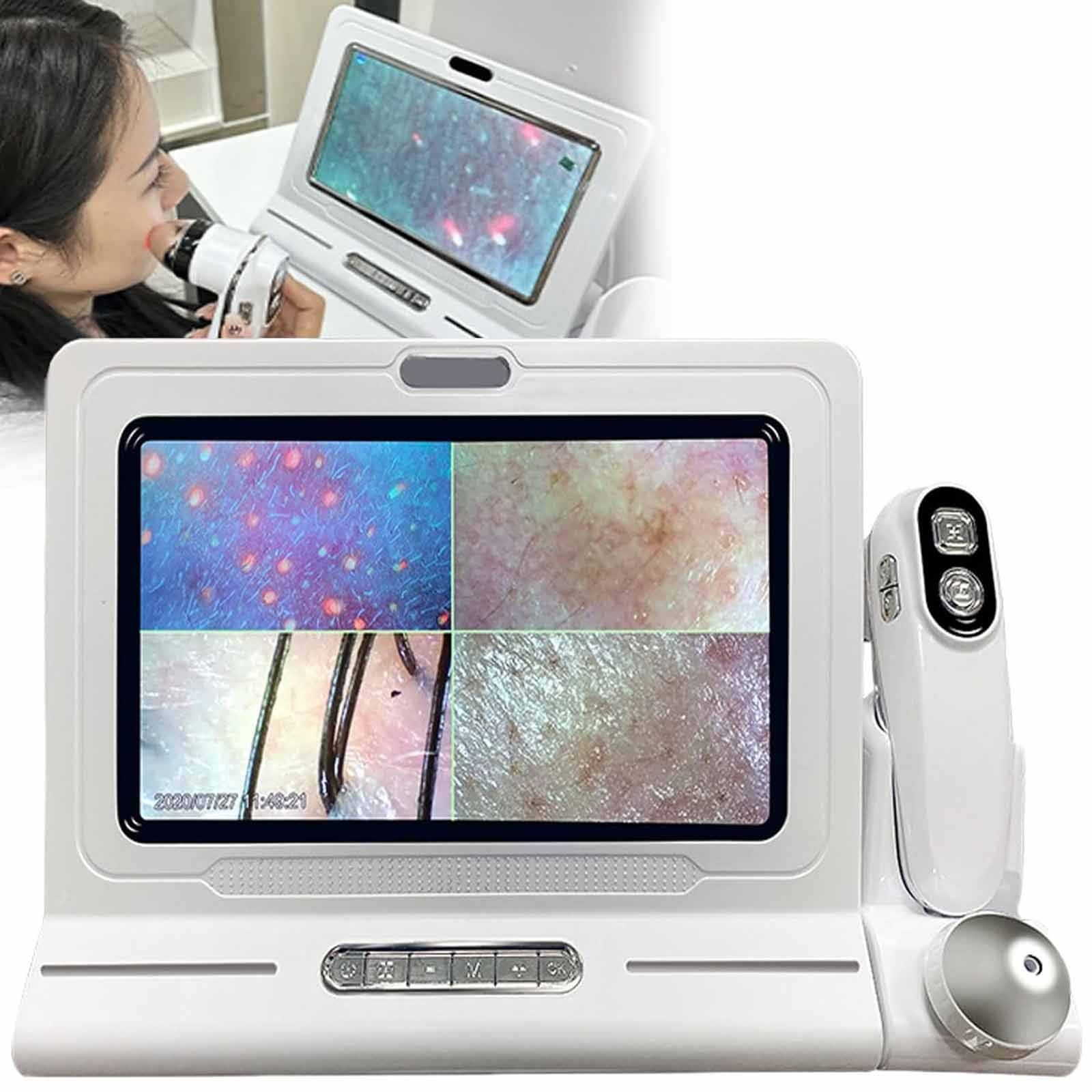 11 Zoll Haut Kopfhaut Detektor Haarfollikel-Hautanalysator-Maschine, Haarfollikel, Haut, Haardetektor, Analysegerät Multifunktionaler Digitaler Hautpflege-Analysegerät