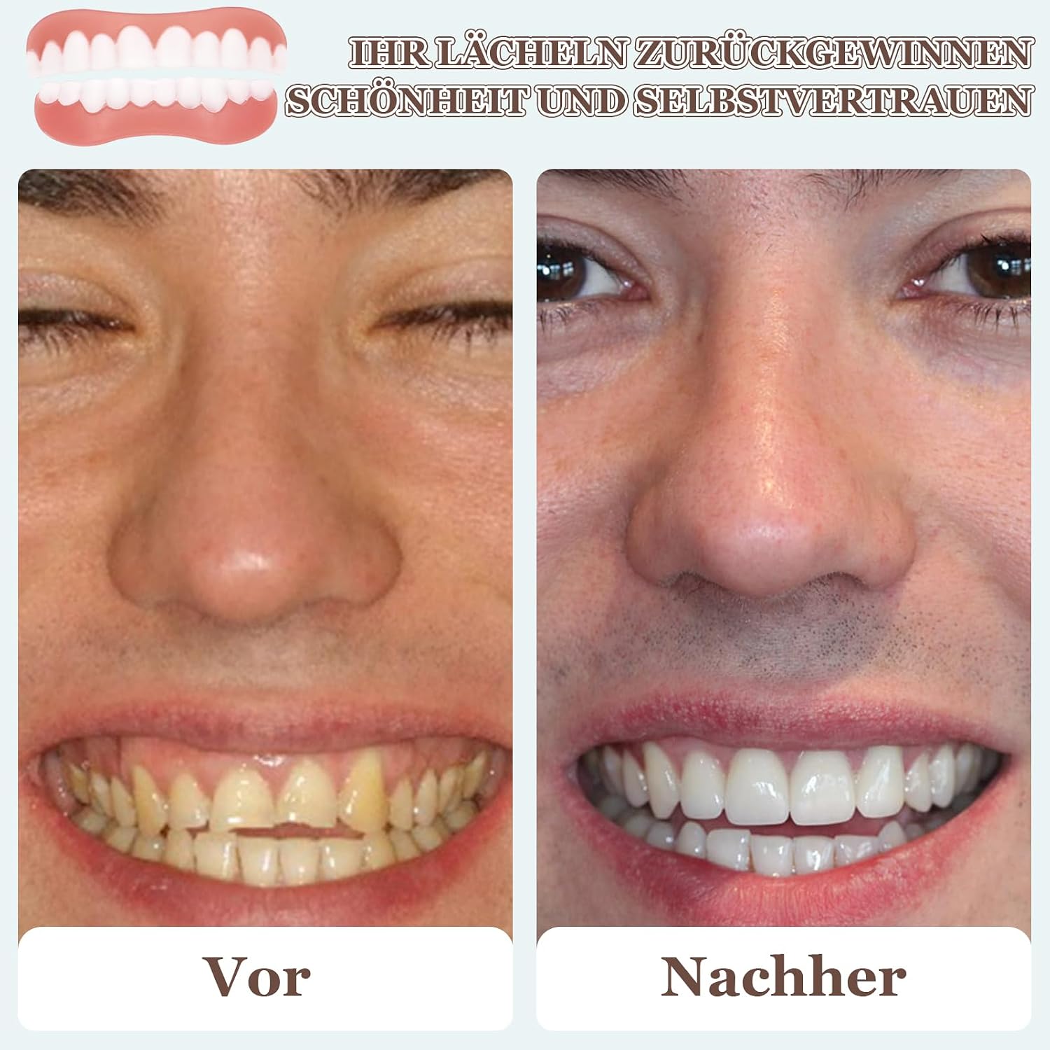4 Paar Geflschte Zhne Falsche Zhne Veneers Qatar | Ubuy