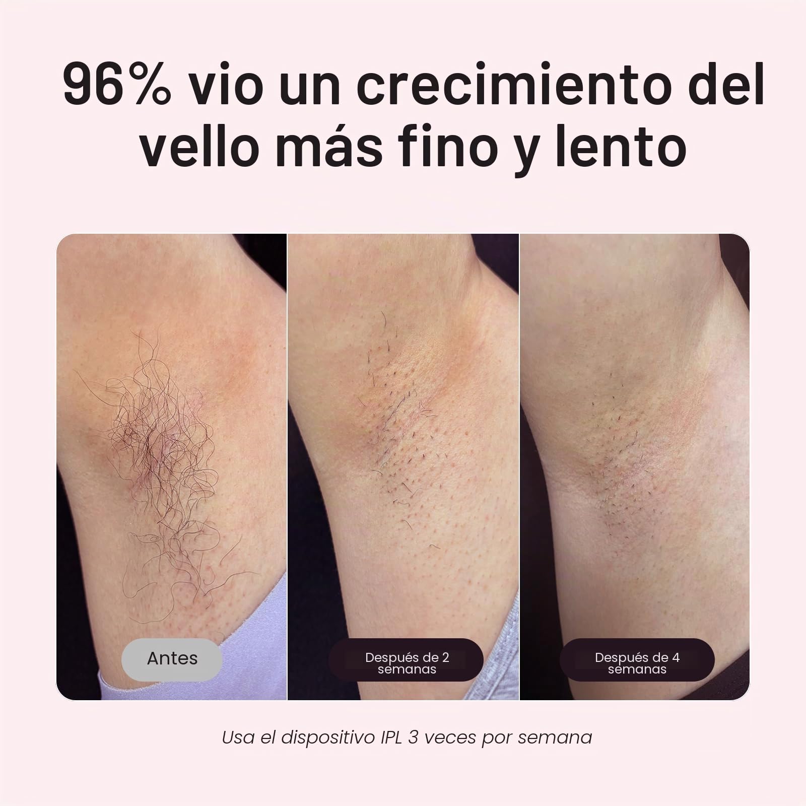Wavytalk 24J Depiladora Luz Pulsada IPL,Maquina Depilación para Mujer Hombre,Tecnología Dual-Pause y Función de Enfriamiento para Piernas, Axilas y Línea del bikini,Funcionamiento con Cable