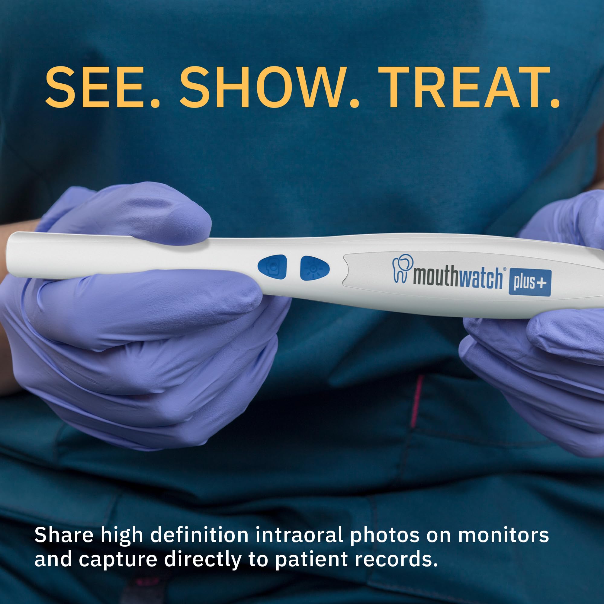 MouthWatch Intraoral Camera, Crystal Clear Images with an Easy to Use, Fast, Single Button Operation Dental Camera, Compatible with Over 50 Dental Imaging Suites, Lightweight and Ergonomic, 31 Grams: HD