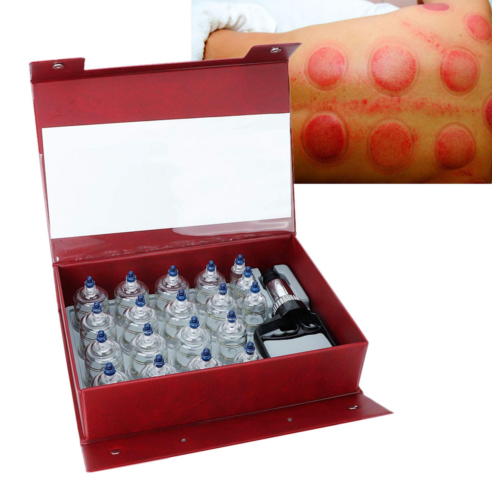 Set di coppettazione con Pompa, Set di coppette Hijama Cinese Ventose per Vuoto Massaggiatore Ventosa Set per del Vuoto per Massaggio con coppettazione Muscoli e articolazioni