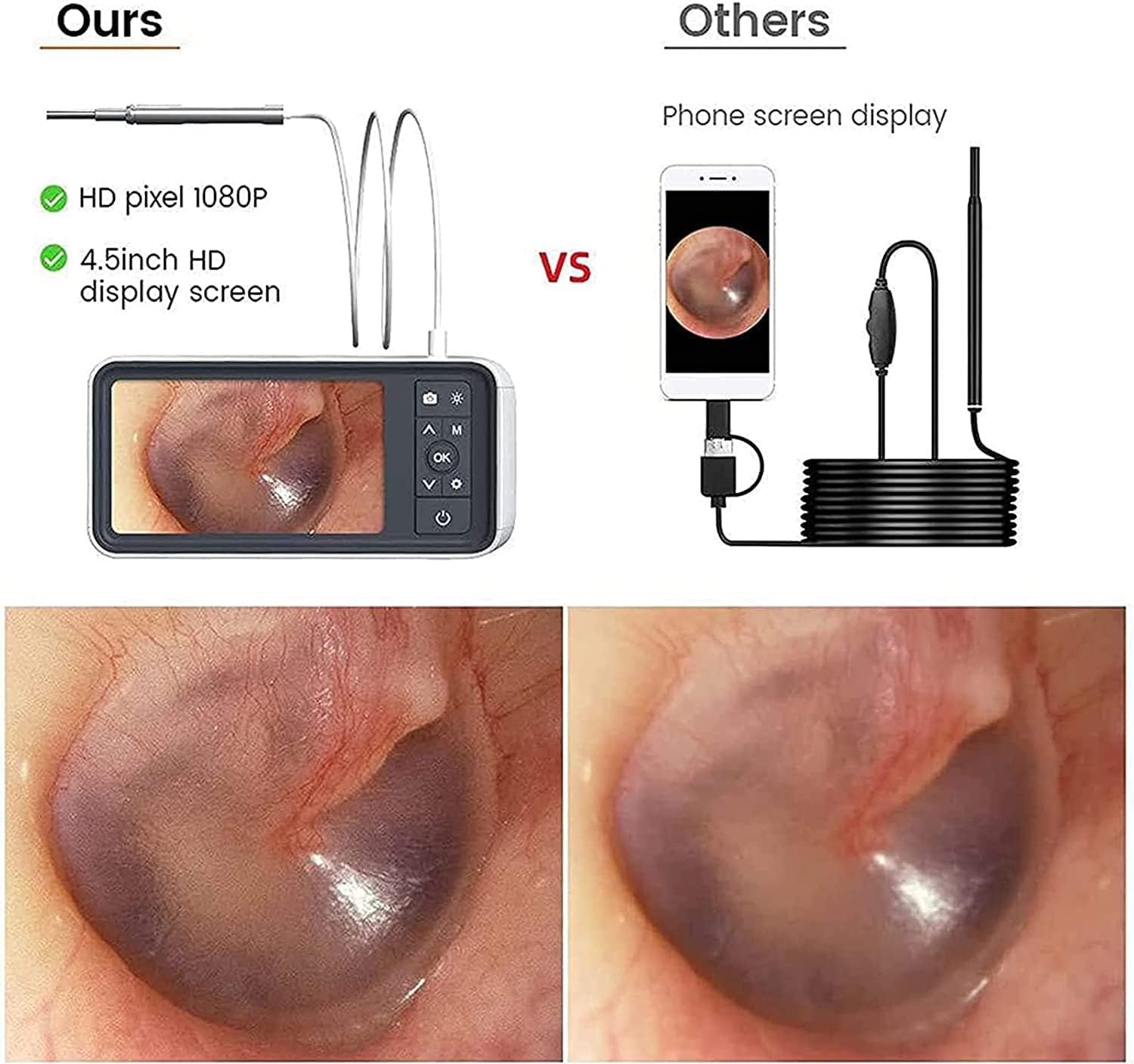 Otoscopio Digital, Endoscopio De Examen del Canal Auditivo Y Nasal, Lente De 3.9 mm, Pantalla De 4.5 Pulgadas, con 6 Luces LED, Adecuado para Adultos, Niños Y Mascotas, gaoyun-1001