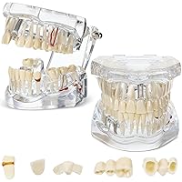 Vista 10 de Modelo de dientes con enfermedad de Outus, modelo de implante dental con dientes removibles, estándar de dientes patológicos para demostración