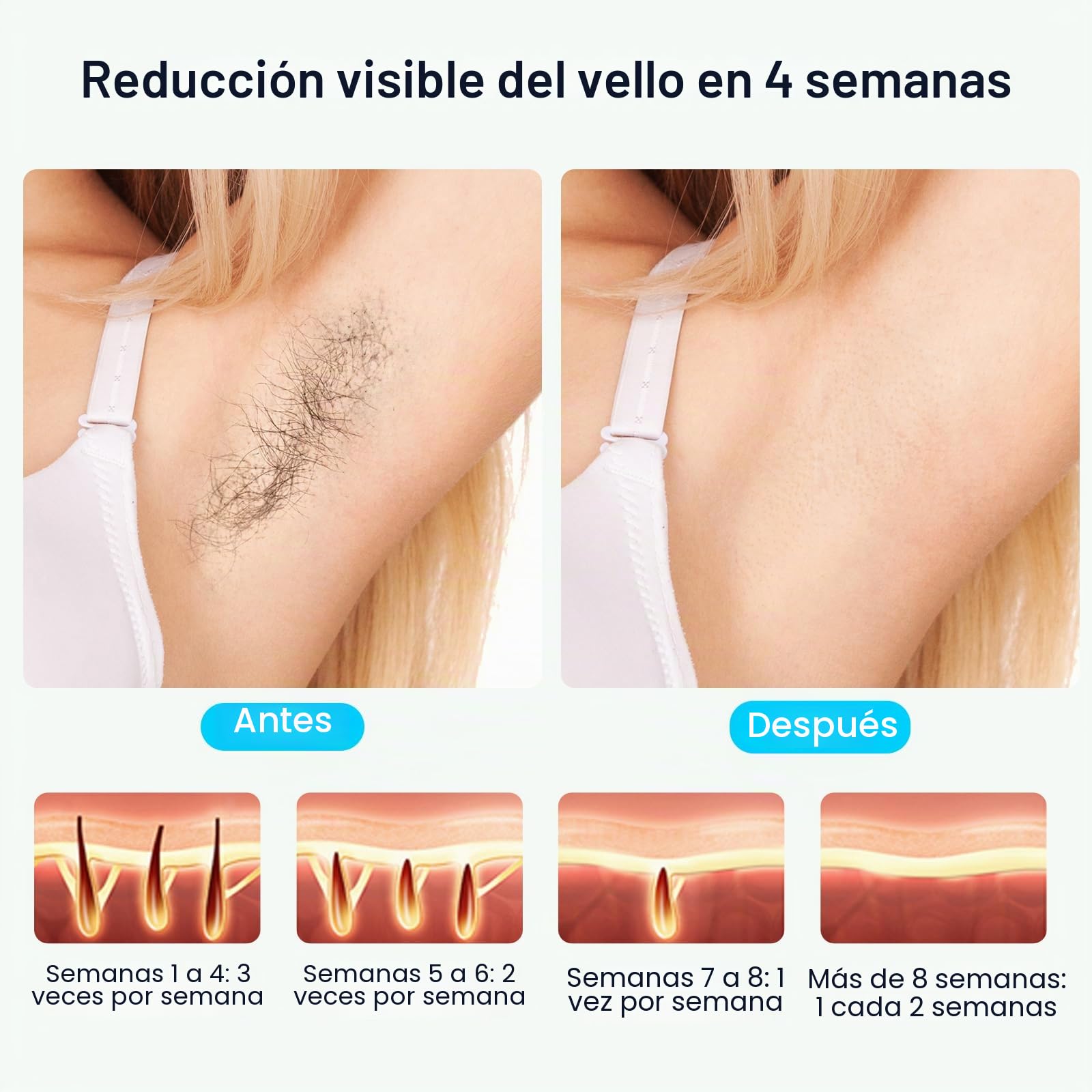 MLAY IPL Depilación con hielo, dispositivo de depilación láser sin dolor, 5 niveles de energía, energía 18J y flash automático, depilación láser en casa para bikinis, axilas