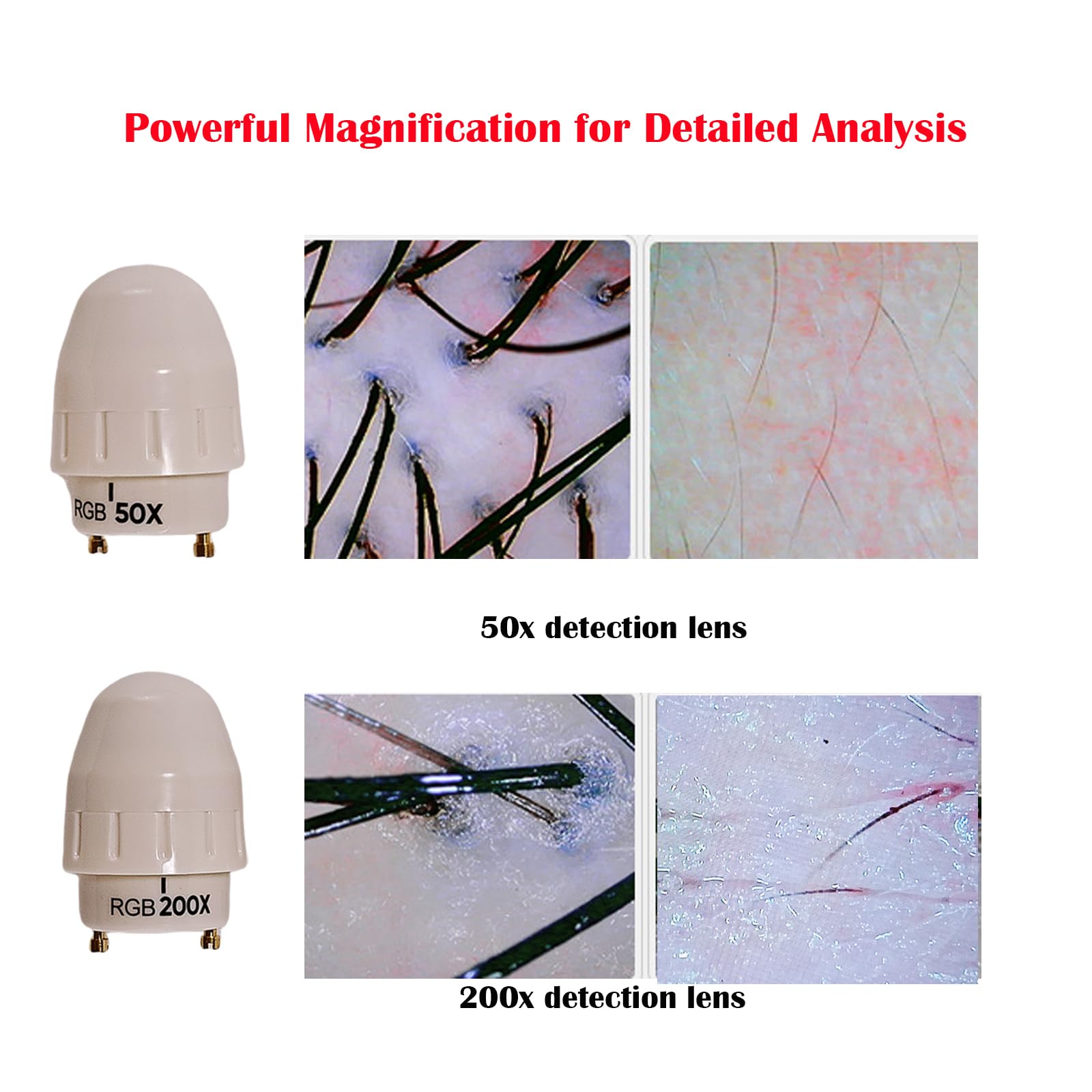 Professional Scalp Camera - Hair & Scalp Analysis -2