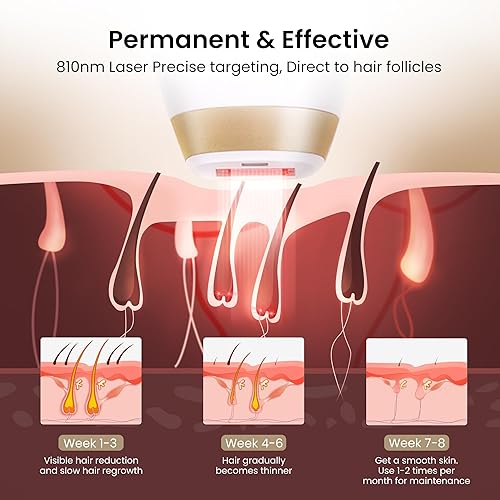 Miniatura 5 de Depilación láser de diodo 810nm para mujeres y hombres, V4S para tono de piel 1-5, el dispositivo de uso doméstico aprobado por la FDA, sistema de