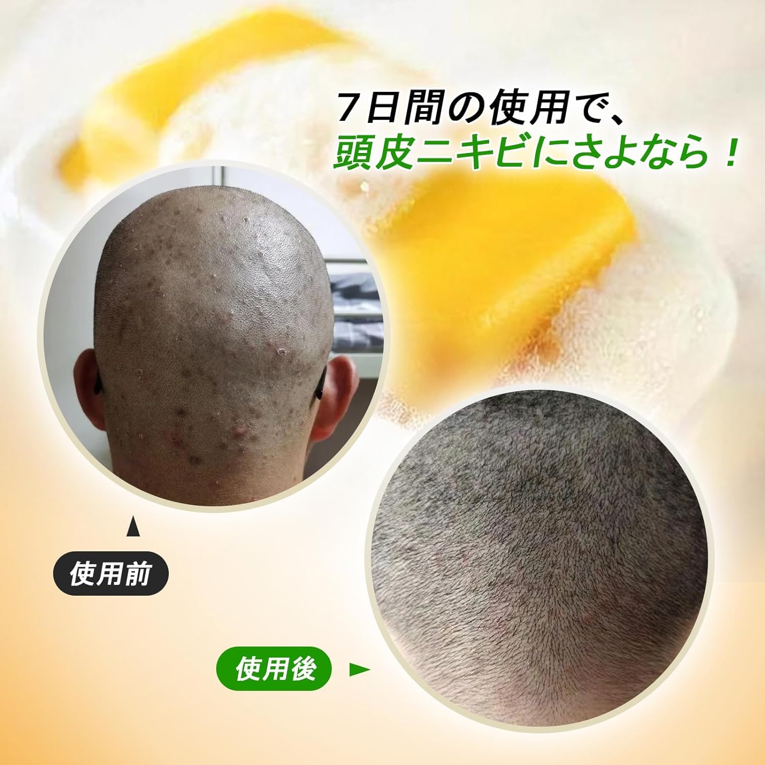 Amazon | 洗顔硫磺皂 石鹸 上海 硫黄石鹸 皮脂コントロール 角質柔化