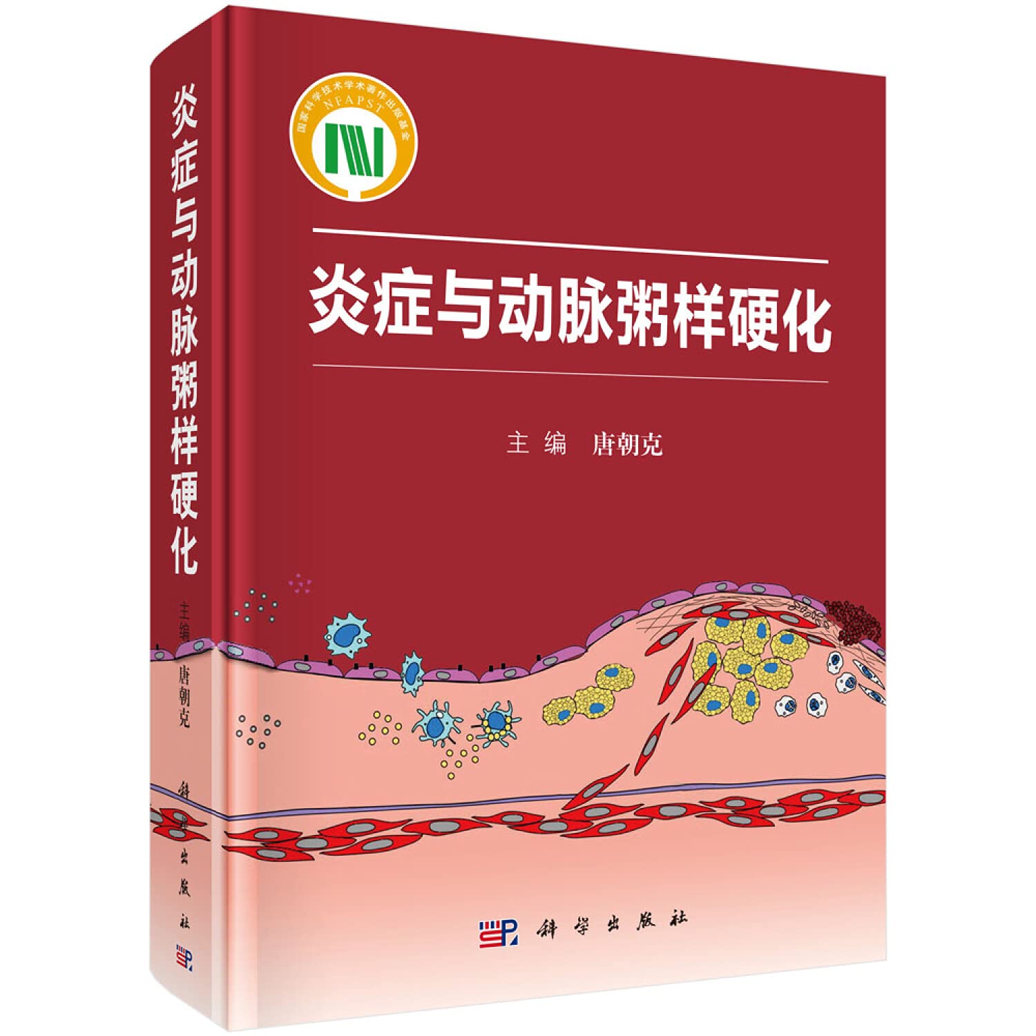 【按需印刷】-炎症与动脉粥样硬化