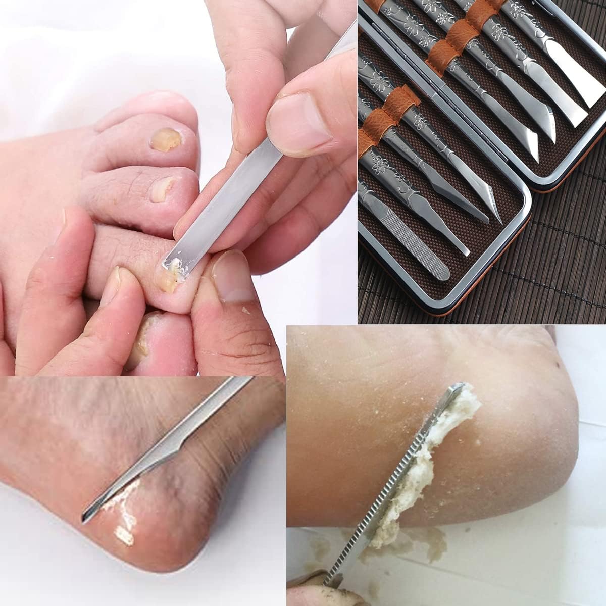 8PCS exfoliating Knife Pedicure Tool, Pedicure Nail Set, Professional Nail Knife Tool, Decorative Foot Cover Care Tool, Foot File Pedicure Set, with Storage Box, Foot File Foot Care, Salon Set