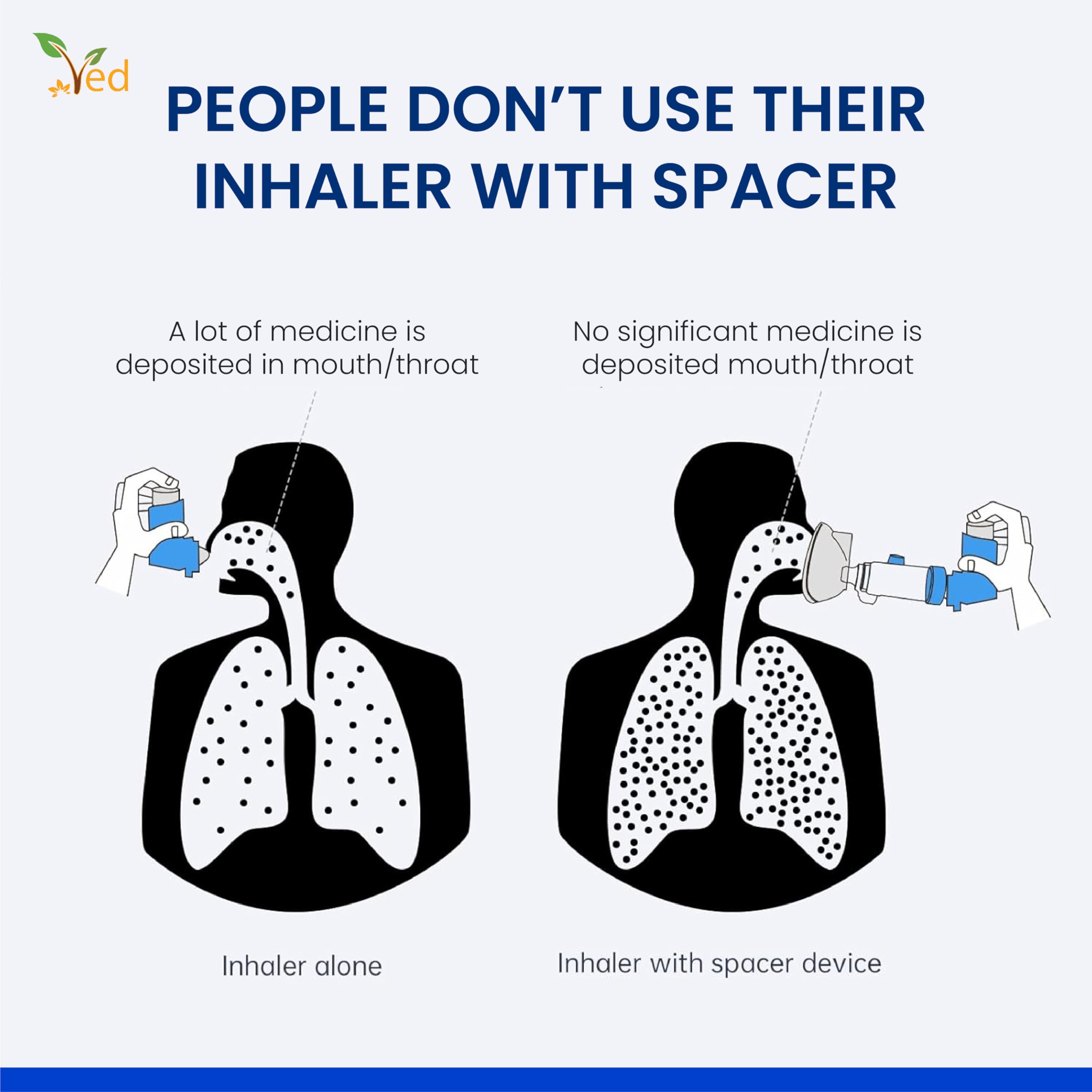 Dispositif d'espacement antistatique pour inhalateur, chambre d'inhalateur, à utiliser avec un inhalateur doseur, sans BPA ni latex pour adulte. (Bleu)