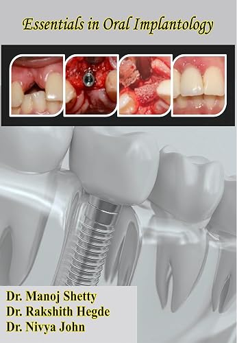 Essentials in Oral Implantology